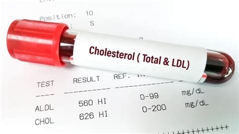 should i fast before a cholesterol test